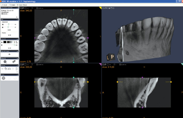 3D software 3D software